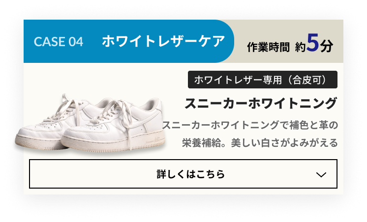 CASE 03 なんだか黒ずんだ!:スニーカーホワイトニング