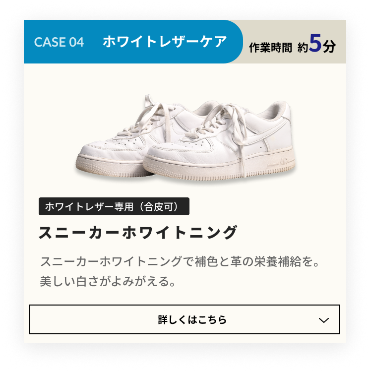 CASE 03 なんだか黒ずんだ!:スニーカーホワイトニング